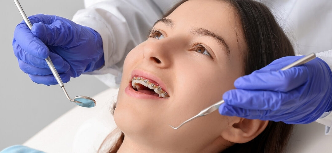 Getting braces at orthadontist