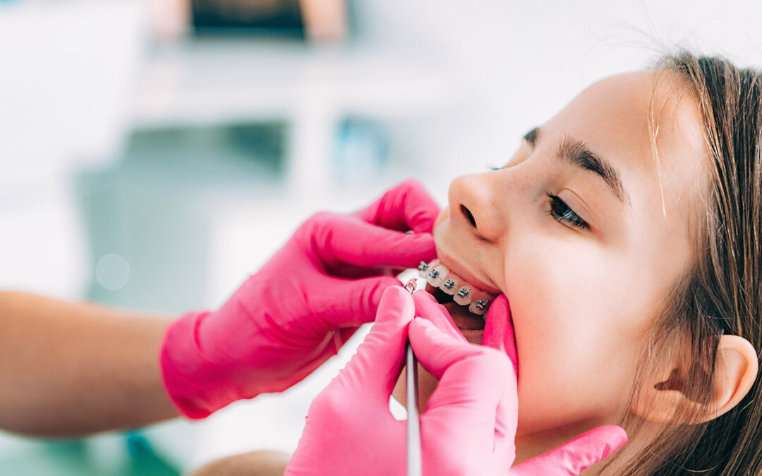 The Benefits of Early Orthodontic Intervention for Children